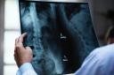 X-Ray